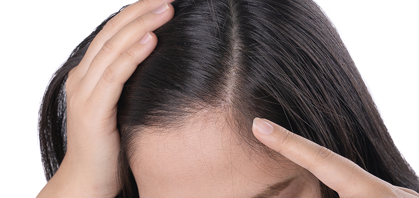Saç Ekimi Uygulanan Hastanın Başarıya Etkisi Nedir?